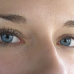 Vorteile Augenlasern